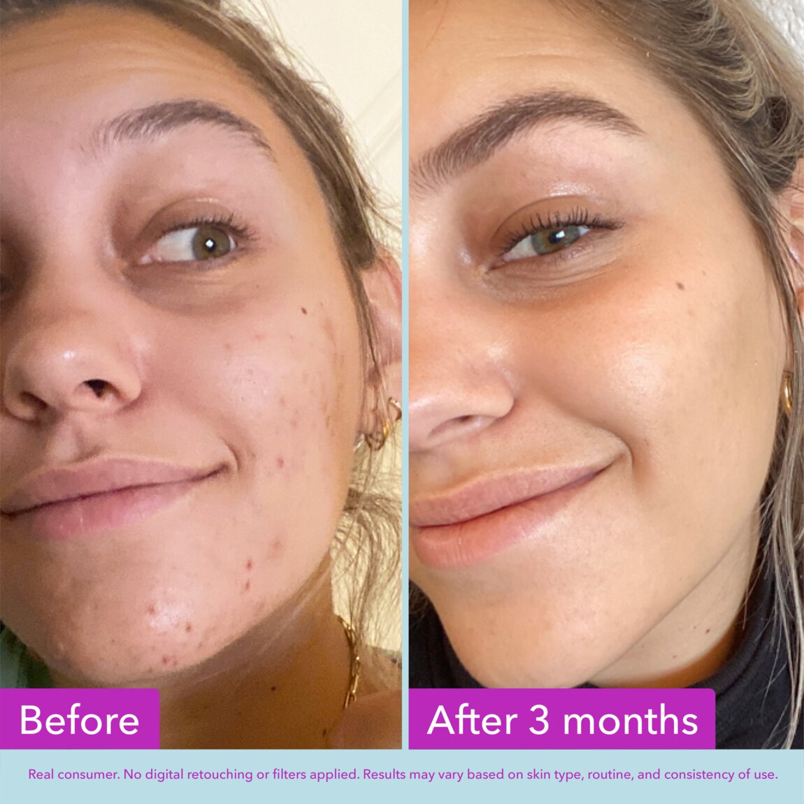 niacinamide-brightening-toner-z1 zb_p.jpg