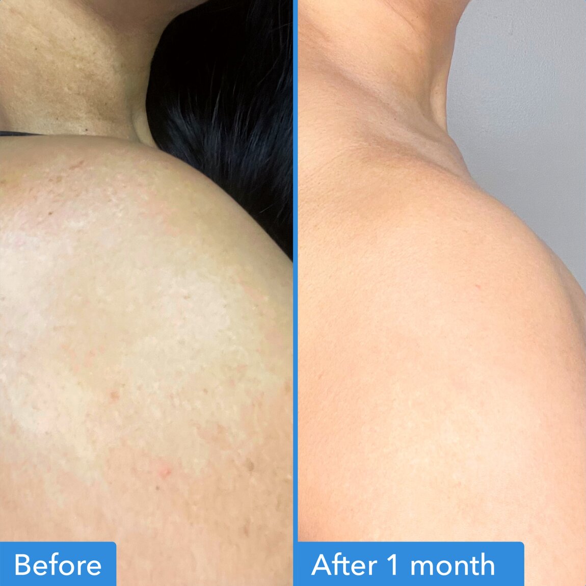 discoloration-correcting-body-treatment-i2 zb_p.jpg