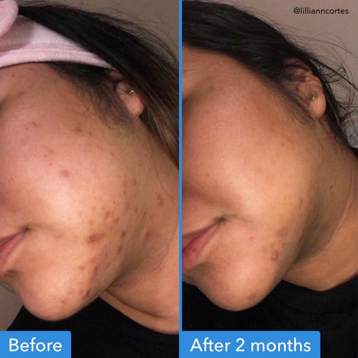 discoloration-correcting-serum-x0 zb_p.jpg